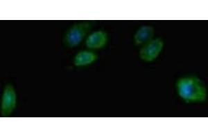 Immunofluorescent analysis of HepG2 cells using ABIN7171658 at dilution of 1:100 and Alexa Fluor 488-congugated AffiniPure Goat Anti-Rabbit IgG(H+L) (TBC1D7 Antikörper  (AA 1-293))
