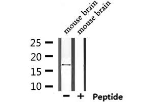 Western blot analysis of extracts from mouse brain, using TRAPPC1 Antibody.