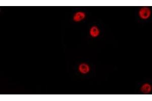 ABIN6275191 staining HepG2 by IF/ICC. (HOXA5 Antikörper  (Internal Region))