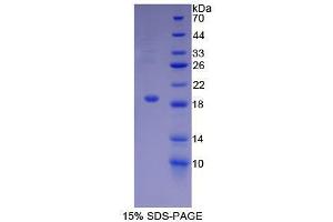 SDS-PAGE analysis of Mouse ACVR2A Protein. (ACVR2A Protein)