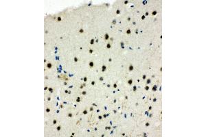 Anti-MCM6 antibody, IHC(P) IHC(P): Rat Brain Tissue (MCM6 Antikörper  (Middle Region))