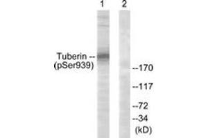 Western blot analysis of extracts from 293 cells treated with Anisomycin 25ug/ml 30', using Tuberin/TSC2 (Phospho-Ser939) Antibody. (Tuberin Antikörper  (pSer939))