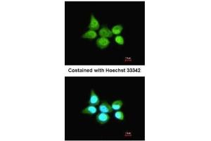ICC/IF Image Immunofluorescence analysis of paraformaldehyde-fixed A431, using SSA1, antibody at 1:200 dilution. (TRIM21 Antikörper)