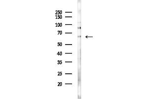 anti-Keratin 16 (KRT16) (C-Term) antibody