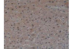 IHC-P analysis of Human Liver Tissue, with DAB staining. (Angiotensin I Converting Enzyme 1 Antikörper  (AA 1160-1306))