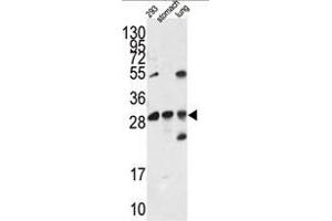 Western blot analysis of EN2 antibody (C-term) in 293 cell line lysates and mouse stomach and lung tissue lysates (35ug/lane). (EN2 Antikörper  (C-Term))