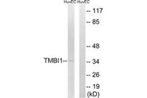 Western blot analysis of extracts from HuvEc cells, using TMBIM1 Antibody. (TMBIM1 Antikörper  (AA 251-300))