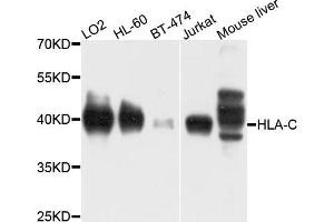 Western blot analysis of extracts of various cells, using HLA-C antibody. (HLA-C Antikörper)