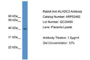 WB Suggested Anti-KLHDC3  Antibody Titration: 0. (KLHDC3 Antikörper  (N-Term))