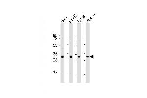 All lanes : Anti-OPN-a/b Antibody (N-term) at 1:2000 dilution Lane 1: Hela whole cell lysate Lane 2: HL-60 whole cell lysate Lane 3: Jurkat whole cell lysate Lane 4: MOLT-4 whole cell lysate Lysates/proteins at 20 μg per lane. (OPN-A,b (AA 14-40), (N-Term) Antikörper)