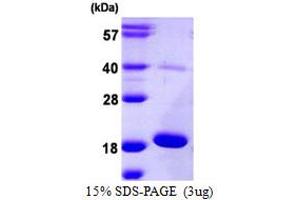 SDS-PAGE (SDS) image for Proopiomelanocortin (POMC) (AA 27-267) protein (His tag) (ABIN667920) (POMC Protein (AA 27-267) (His tag))