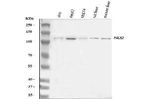 Western blot analysis of PALB2 using anti-PALB2 antibody (ABIN7601758).