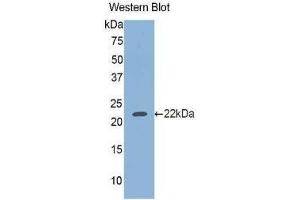 Western Blotting (WB) image for anti-Glucosidase, Beta, Acid (GBA) (AA 334-498) antibody (ABIN1858968) (GBA Antikörper  (AA 334-498))