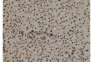 ABIN6273179 at 1/100 staining Rat liver tissue by IHC-P.