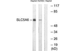 Western blot analysis of extracts from HepG2/HuvEc cells, using SLC5A6 Antibody.