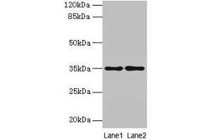 Western blot All lanes: SDSL antibody at 4 μg/mL Lane 1: HepG2 whole cell lysate Lane 2: Mouse liver tissue Secondary Goat polyclonal to rabbit IgG at 1/10000 dilution Predicted band size: 35 kDa Observed band size: 35 kDa (SDSL Antikörper  (AA 39-169))