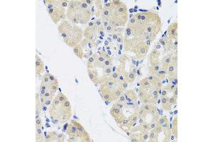 Immunohistochemistry of paraffin-embedded human gastric using ALAD antibody at dilution of 1:100 (x40 lens). (ALAD Antikörper)