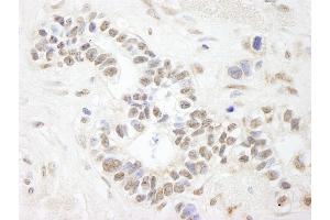 Immunohistochemistry (IHC) image for anti-Ankyrin Repeat and SAM Domain-Containing Protein 3 (ANKS3) (AA 606-656) antibody (ABIN7448411)