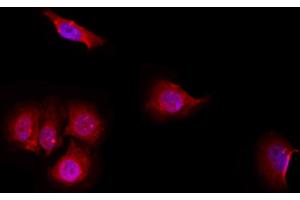 ABIN6257071 and ABIN6274969 staining Hela by IF/ICC. (CPE Antikörper  (Internal Region))