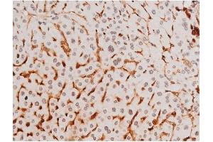 Immunohistochemistry (IHC) image for anti-Spleen tyrosine Kinase (SYK) (pTyr525) antibody (ABIN6255944)