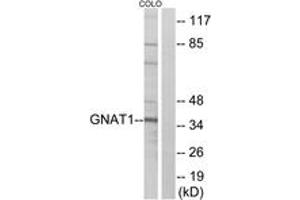Western blot analysis of extracts from COLO cells, using GNAT1 Antibody. (GNAT1 Antikörper  (AA 71-120))