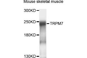 Western blot analysis of extracts of mouse skeletal muscle, using TRPM7 antibody (ABIN4905504) at 1:1000 dilution. (TRPM7 Antikörper)