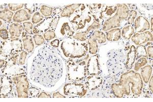 Immunohistochemical analysis of paraffin-embedded Human kidney section using Pink1 (ABIN1538954 and ABIN2849886). (FH Antikörper  (N-Term))