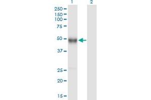 anti-Immunoglobulin Heavy Constant gamma 4 (G4m Marker) (IGHG4) (AA 1-473) antibody