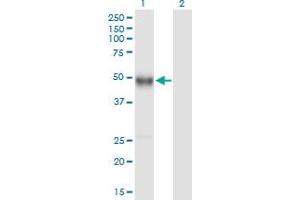 Western Blot analysis of IGHG4 expression in transfected 293T cell line by IGHG4 MaxPab polyclonal antibody. (IGHG4 Antikörper  (AA 1-473))
