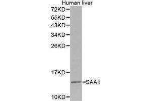 Western Blotting (WB) image for anti-Serum Amyloid A1 (SAA1) (AA 19-122) antibody (ABIN3022331) (SAA1 Antikörper  (AA 19-122))