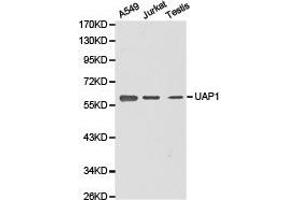 Western Blotting (WB) image for anti-UDP-N-Acteylglucosamine Pyrophosphorylase 1 (UAP1) antibody (ABIN1875243) (UAP1 Antikörper)