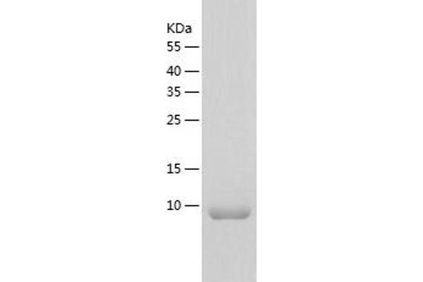 Cytochrome b5 (CYTB5) (AA 1-108) protein (His tag)