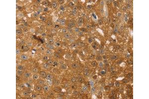 Immunohistochemistry (IHC) image for anti-Thymosin beta 10 (TMSB10) antibody (ABIN2433967) (Thymosin beta 10 Antikörper)