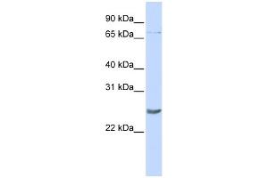 WB Suggested Anti-PRDM5 Antibody Titration:  0. (PRDM5 Antikörper  (Middle Region))