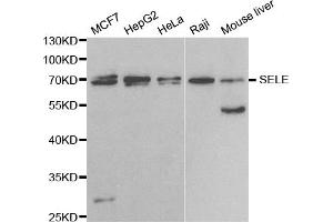 Western blot analysis of extracts of various cell lines, using SELE antibody. (Selectin E/CD62e Antikörper)