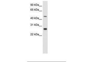 Image no. 1 for anti-Spermatogenic Leucine Zipper 1 (SPZ1) (C-Term) antibody (ABIN202383) (SPZ1 Antikörper  (C-Term))