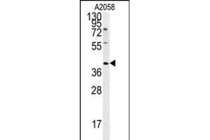 CD99L2 Antibody (Center) (ABIN651686 and ABIN2840361) western blot analysis in  cell line lysates (35 μg/lane). (CD99L2 Antikörper  (AA 39-66))