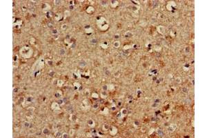 Immunohistochemistry of paraffin-embedded human brain tissue using ABIN7174052 at dilution of 1:100