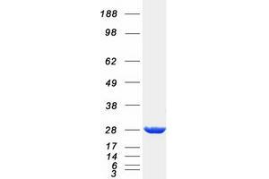 Western Blotting (WB) image for Platelet-Activating Factor Acetylhydrolase 1b, Catalytic Subunit 3 (29kDa) (PAFAH1B3) (Transcript Variant 2) protein (Myc-DYKDDDDK Tag) (ABIN2728148)