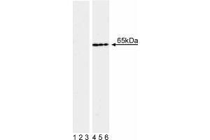 Western blot analysis of NF-kappaB p65 (pS536) in transformed human epithelioid carcinoma. (NF-kB p65 Antikörper  (pSer536))