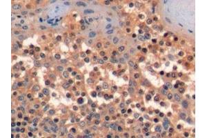 Detection of CD34 in Human Tonsil Tissue using Polyclonal Antibody to Cluster Of Differentiation 34 (CD34) (CD34 Antikörper  (AA 32-290))