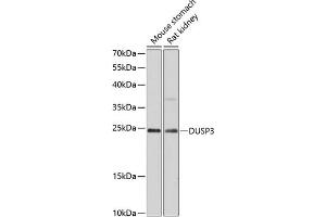 Western blot analysis of extracts of various cell lines, using DUSP3 antibody (ABIN6127792, ABIN6139873, ABIN6139874 and ABIN6215639) at 1:3000 dilution. (Dual Specificity Phosphatase 3 (DUSP3) (AA 1-185) Antikörper)