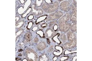 Immunohistochemical staining of human kidney with C11orf86 polyclonal antibody  shows strong cytoplasmic positivity in subsets of tubules at 1:50-1:200 dilution. (C11ORF86 Antikörper)