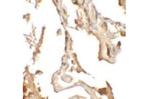 Immunohistochemical analysis of RILPL2 in human lung tissue with RILPL2 polyclonal antibody  at 2.