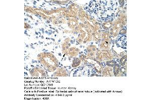 Rabbit Anti-NXF5 Antibody  Paraffin Embedded Tissue: Human Kidney Cellular Data: Epithelial cells of renal tubule Antibody Concentration: 4. (NXF5 Antikörper  (Middle Region))