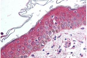 Immunohistochemistry (IHC) image for anti-Wingless-Type MMTV Integration Site Family, Member 10B (WNT10B) (Internal Region) antibody (ABIN1049469)