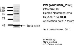 Western Blotting (WB) image for anti-Promyelocytic Leukemia (PML) (Middle Region) antibody (ABIN2778427) (PML Antikörper  (Middle Region))
