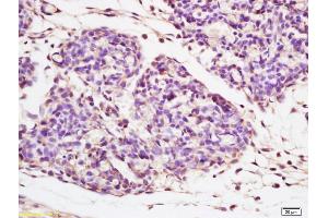 Formalin-fixed and paraffin embedded mouse embryo tissue labeled with Anti-Beta galactosidase Polyclonal Antibody, Unconjugated (ABIN1386129) at 1:200 followed by conjugation to the secondary antibody and DAB staining (GLB1 Antikörper  (AA 301-380))