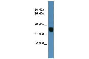 Western Blot showing AKR1C1 antibody used at a concentration of 1-2 ug/ml to detect its target protein. (AKR1C1 Antikörper  (N-Term))