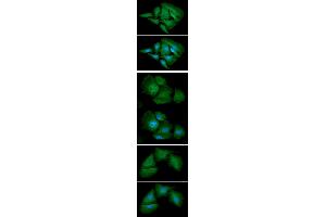 ICC/IF analysis of AK1 in HeLa cell line, stained with DAPI (Blue) for nucleus staining and monoclonal anti-human AK1 antibody (1:100) with goat anti-mouse IgG-Alexa fluor 488 conjugate (Green). (Adenylate Kinase 1 Antikörper  (AA 1-194))